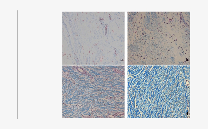 Histological Images Of Collagen Tissue Hyperplasia - Tile, transparent png download