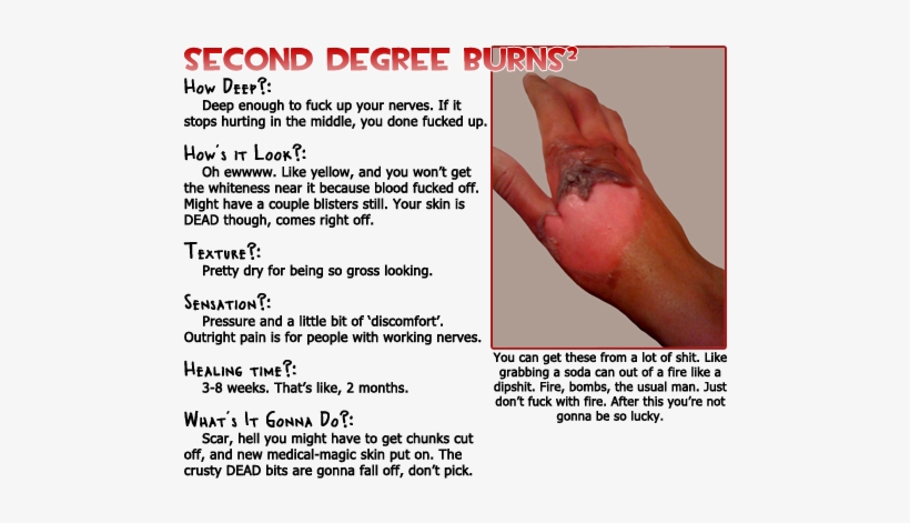 Later On It Still Has A Sort Of Tougher Texture, And - Second Degree Burn Chart, transparent png download