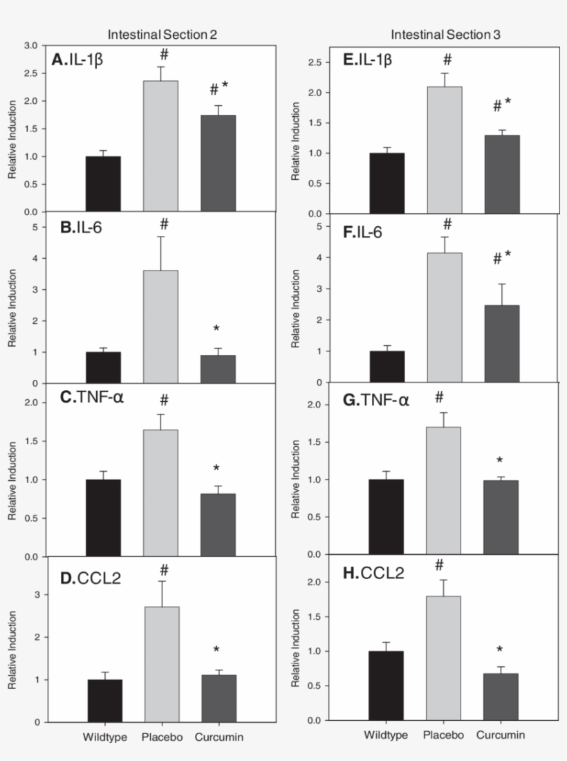Curcumin Blunts Increased Mrna Expression Of Interleukin - Monochrome, transparent png download