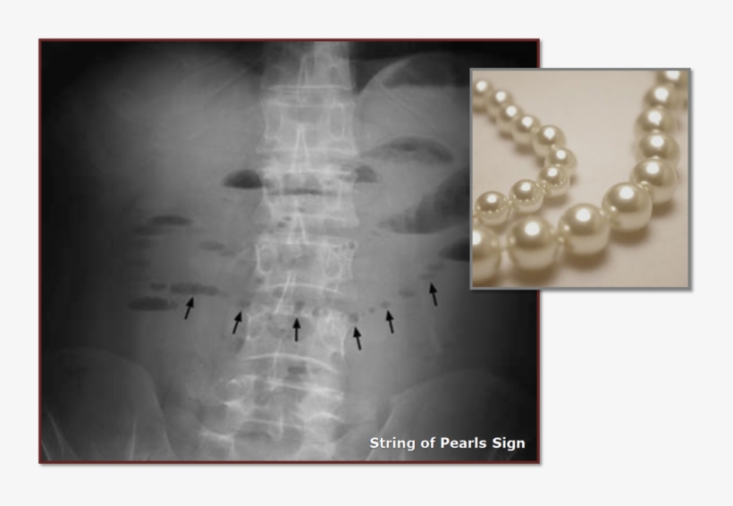String Of Pearls Png Download - String Of Pearls Sign, transparent png download