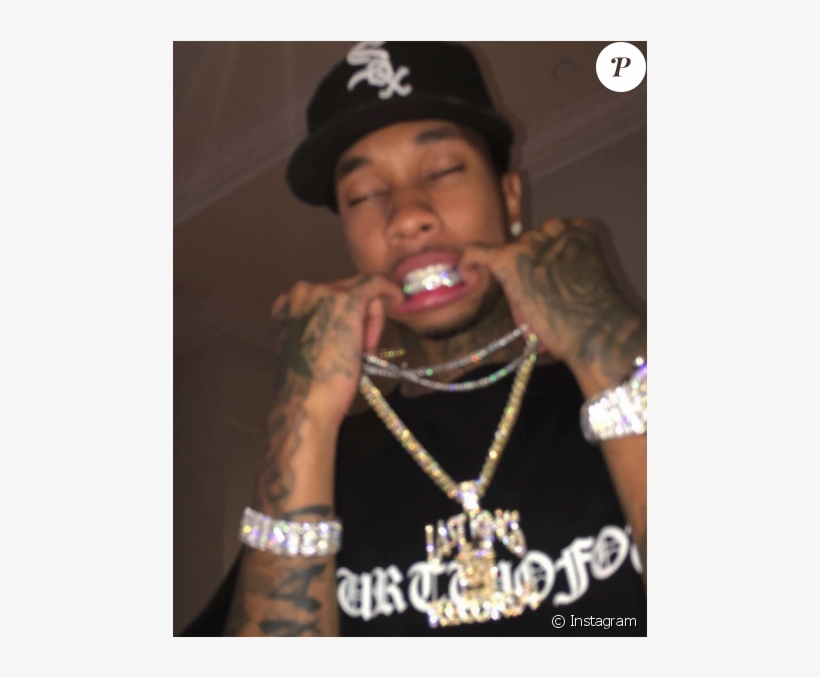 Tyga Posant Avec Ses Fameux Grillz En Or Et Diamant - Tyga Grillz, transparent png download