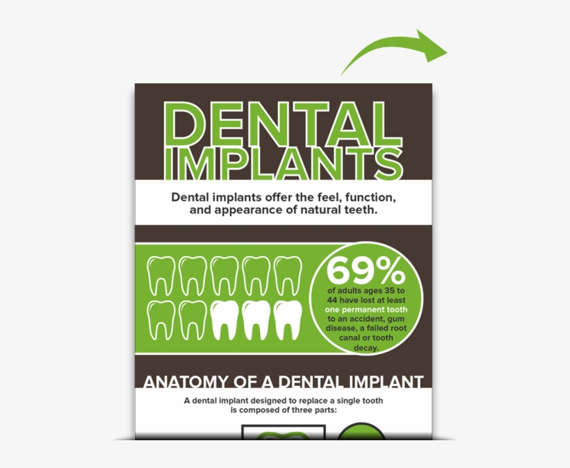 Dental Implants Muncie - Dental Implant Offers, transparent png download