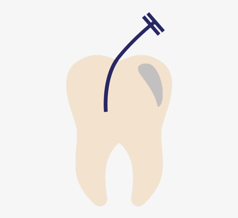 Endodontist Jacksonville Fl - Endodontics, transparent png download
