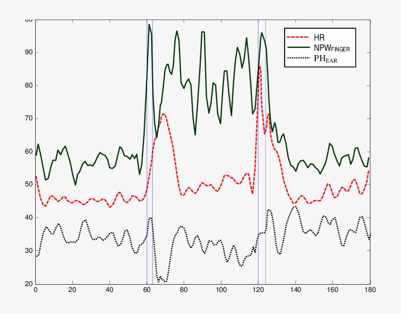 Filtered Heart Rate , Normalized Pulse Width (npw Finger - Heart Rate, transparent png download