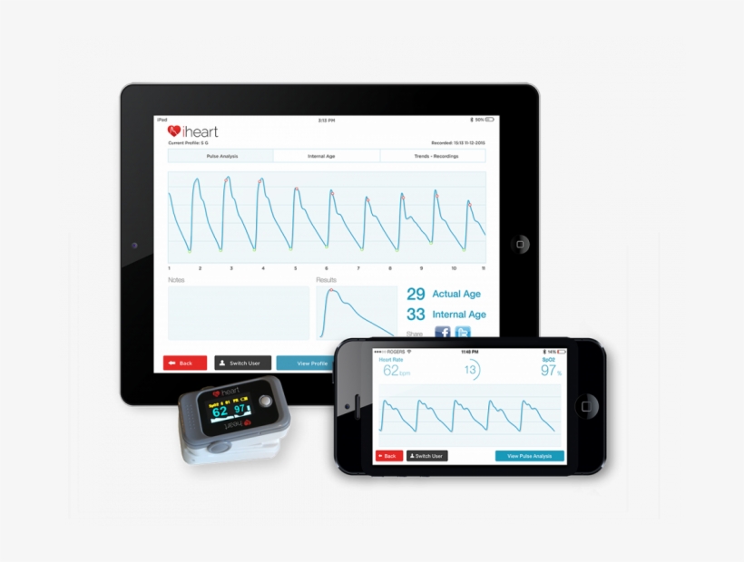 Five Years Ago, Pulse Wave Velocity Was A Relatively - Pulse Wave Velocity Device, transparent png download