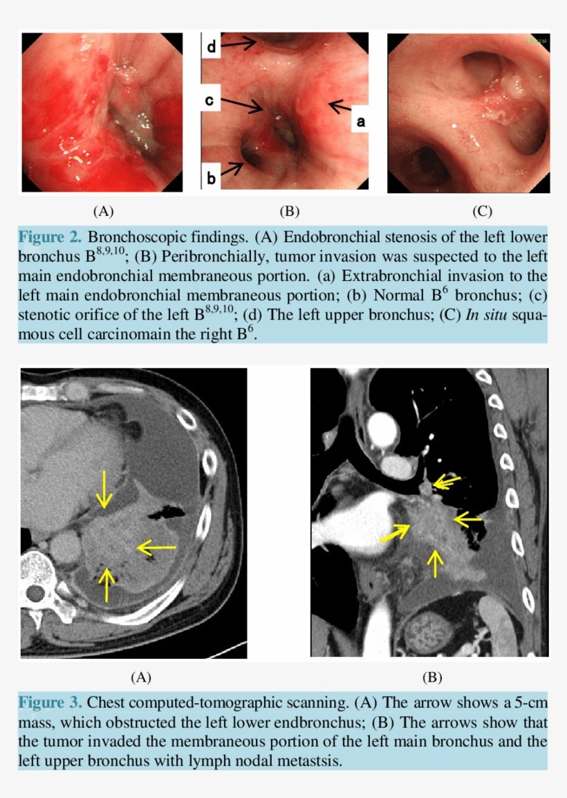 Chest X - Library, transparent png download
