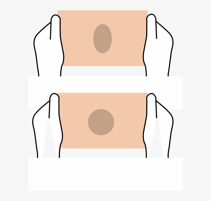 Correct Size Bandage, Correct Stretch Bandage - Pressure System Urgo K2, transparent png download