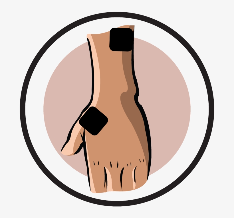 Flexor Of Finger/wrist Electrode Pad Placement - Tens Electrode Placement Thumb, transparent png download
