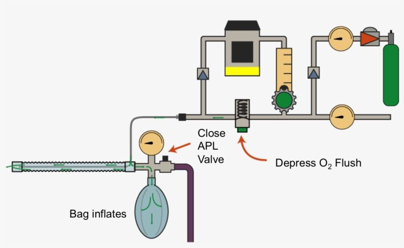 If The Inner Tube Is Disconnected, The Bag Inflates - Diagram, transparent png download