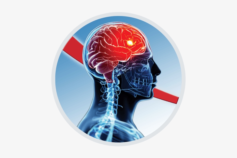 X-ray, transparent png download