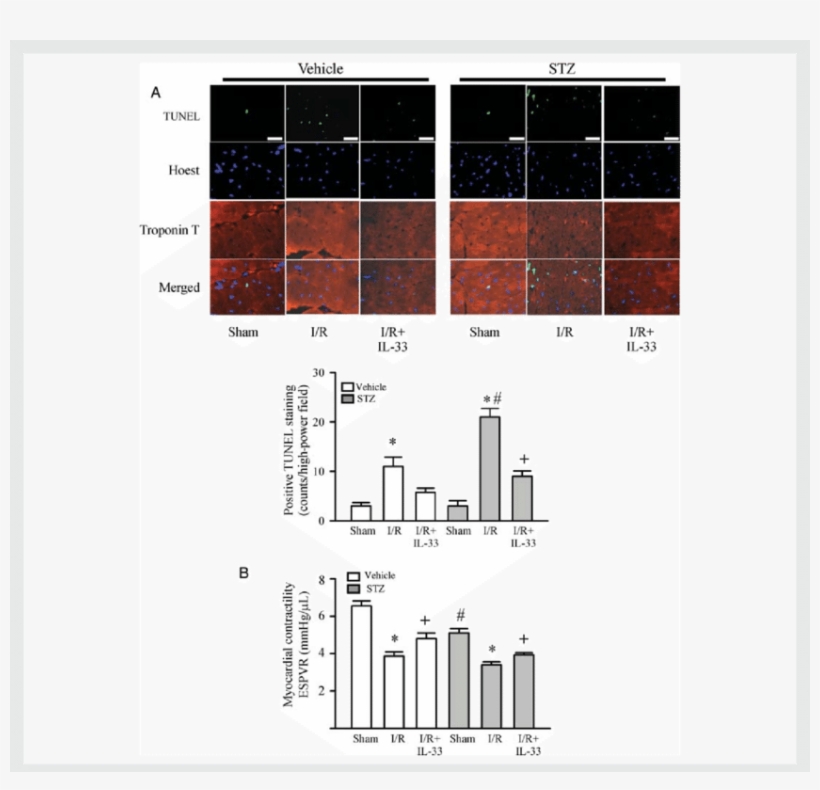 /r Results In An Exaggerated Myocardial Apoptosis And - Floor Plan, transparent png download