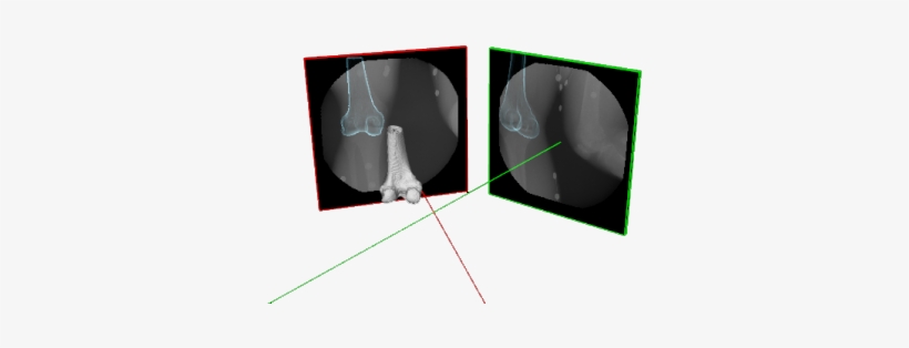 Processing Requires A Hi Res Ct Scan Of The Subject, - Radiology, transparent png download