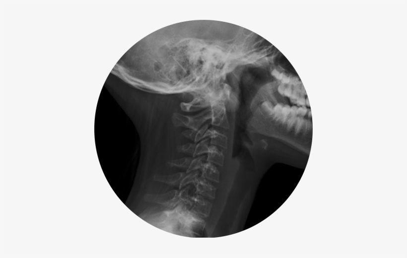 Digital X-ray - X Ray Png Transparent, transparent png download
