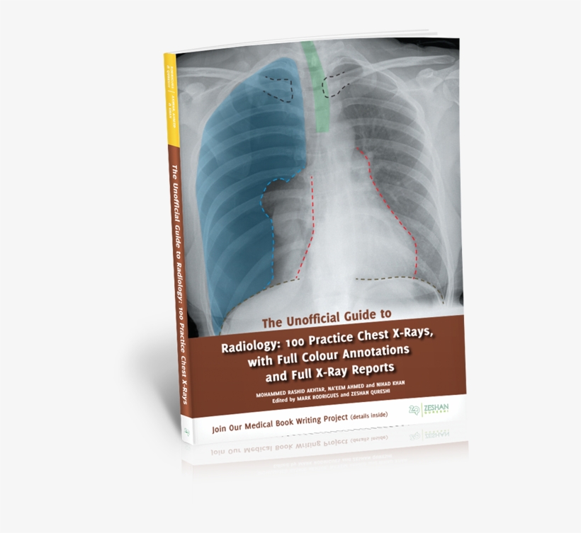 Buy The Unofficial Guide To Radiology - Unofficial Guide To Radiology: 100 Practice Chest X-rays,, transparent png download