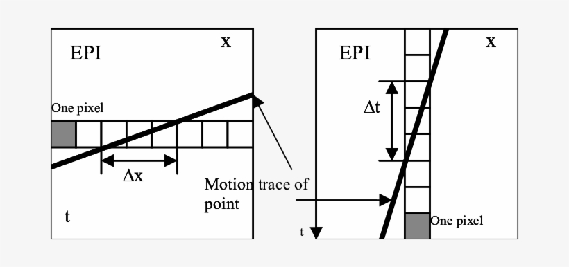 Traces Of Fast And Slow Moving Features In The Epi, - Diagram, transparent png download
