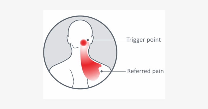 Ways You Can Manage Headache Pain - Graphic Design, transparent png download