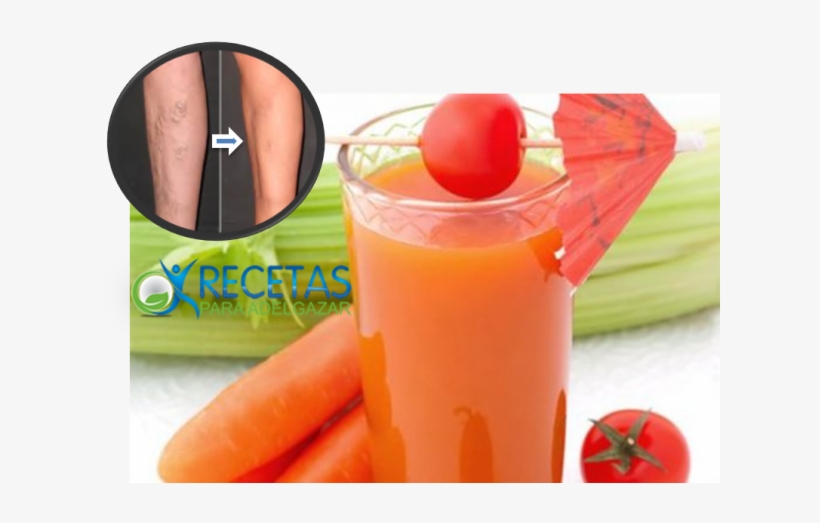 Piernas Cansadas O Hinchadas Y/o Padeces De Varices, - Batido Para La Circulacion, transparent png download