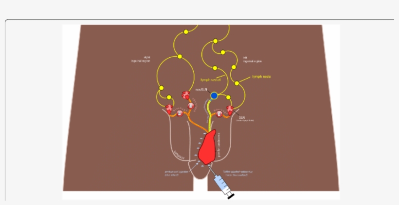Schematic Representation Of Inguinal Lymphatic Drainage - Manual Lymphatic Drainage, transparent png download