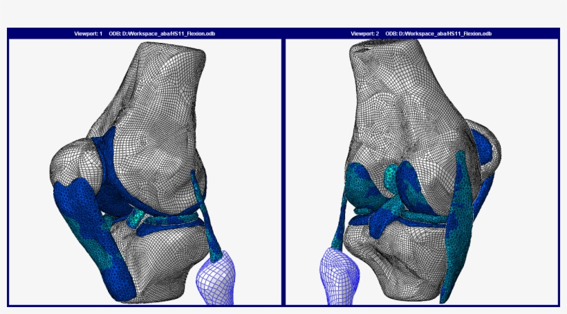 Human Knee Joint Fe Model - Human Knee Finite Element Method, transparent png download