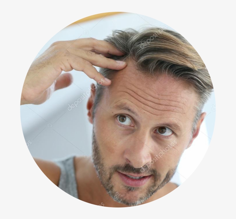 Come In And Discuss Whether You Might Be A Good Candidate - Male Hair Loss, transparent png download