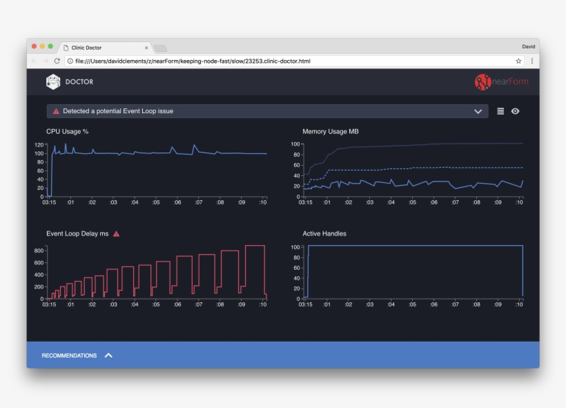 Clinic Doctor Has Detected An Event Loop Issue - Node Js, transparent png download