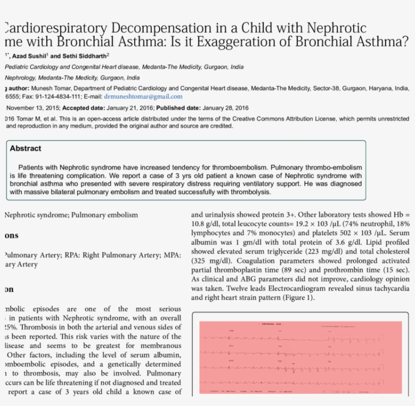 12 Lead Ecg Showing Sinus Tachycardia, Deep 's' Wave - Electrocardiography, transparent png download