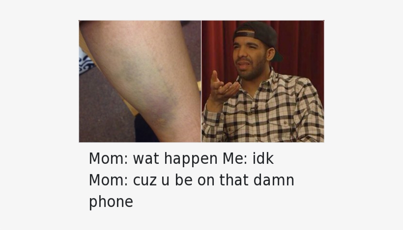 Confused, Drake, And Mfw - They See Your Message But Don T Reply, transparent png download