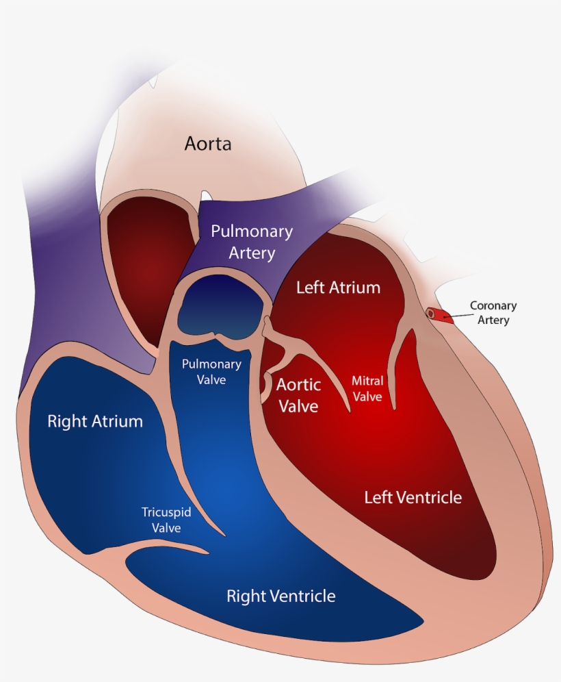 The Human Heart Has Four Valves - Severely Dilated Left Atrium, transparent png download