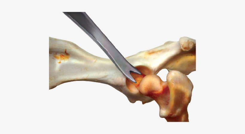 Femoral Head Diarticulator, Large - Femoral Head, transparent png download