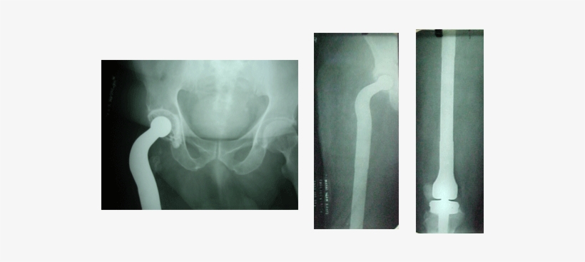 12 Yrs Follow - X-ray, transparent png download