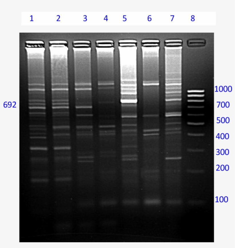Amplification Of Type And Sex Wise Pooled Yak Dna By - Architecture, transparent png download
