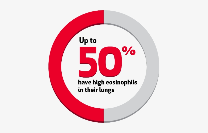 Up To 50% Of People With Severe Asthma Have High Eosinophils - Asthma, transparent png download