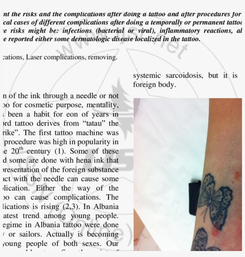 Reddish Purple Papules And Nodules Arranged In An Annular - Nodule, transparent png download