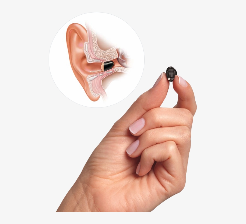 Starkey Muse Iic - Soundlens Starkey, transparent png download