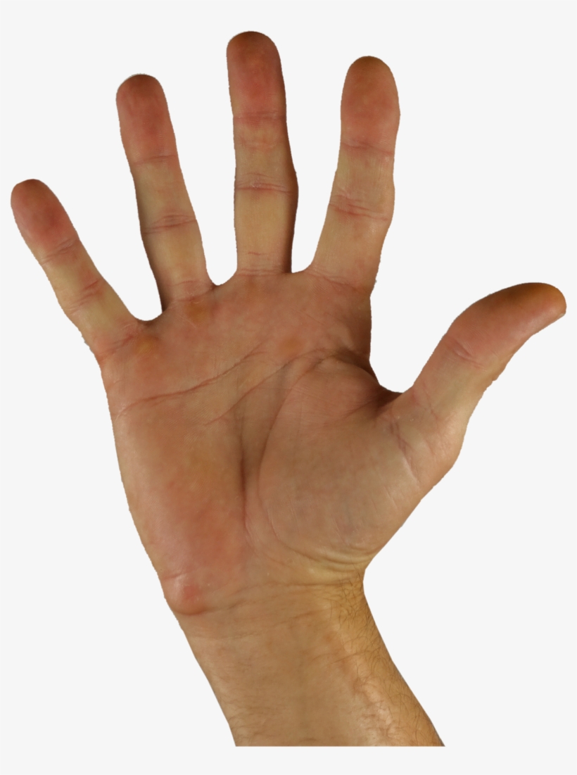Sabañones En Las Yemas De Los Dedos, transparent png download