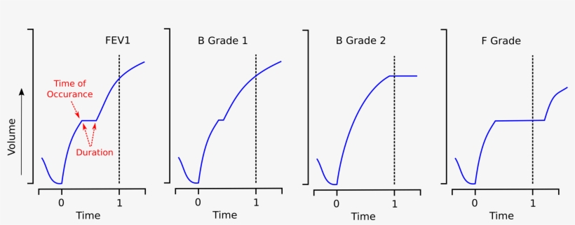 What Matters Is The Duration Of The Pause Within The - Diagram, transparent png download