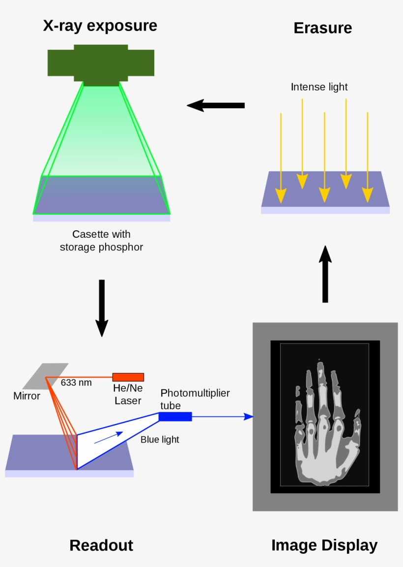 Open - Computed Radiography, transparent png download