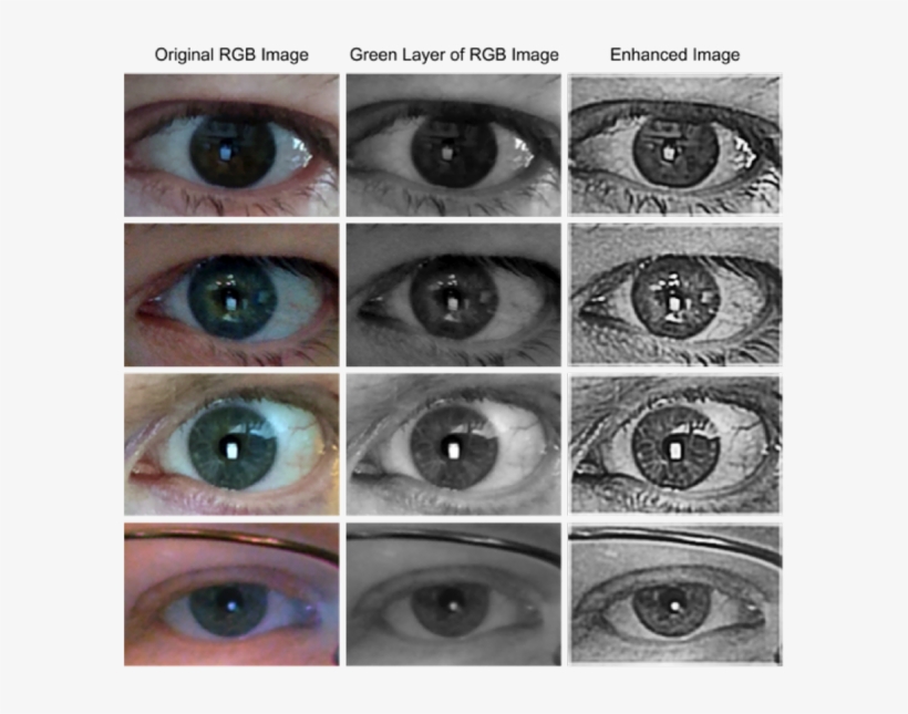 Complaint Filed Against Eye-vein Biometrics Firm 08 - Filing, transparent png download