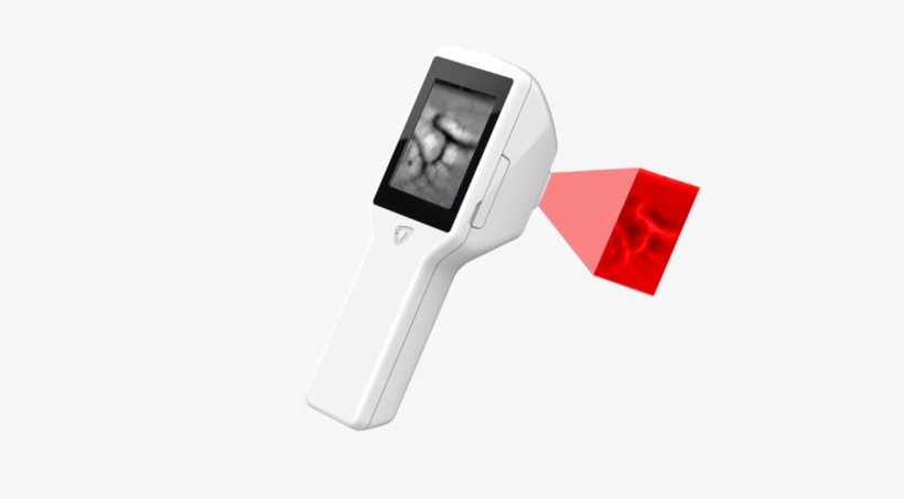 Infra Eyes Veinus Pro - Bengaluru, transparent png download