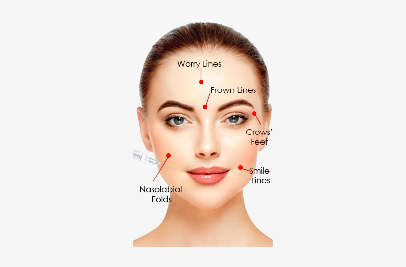 Vampire Facial - Anti Wrinkle Injection Sites, transparent png download