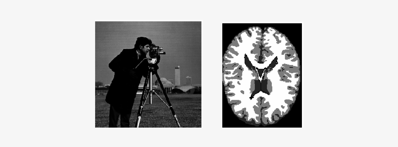 Original Images 'cameraman' And Phantom Of A Brain - Monochrome, transparent png download