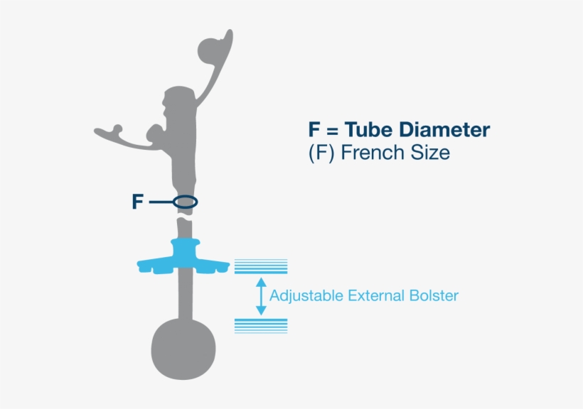 The Amt Balloon G-tube Comes In A Variety Of Sizes - Graphic Design, transparent png download