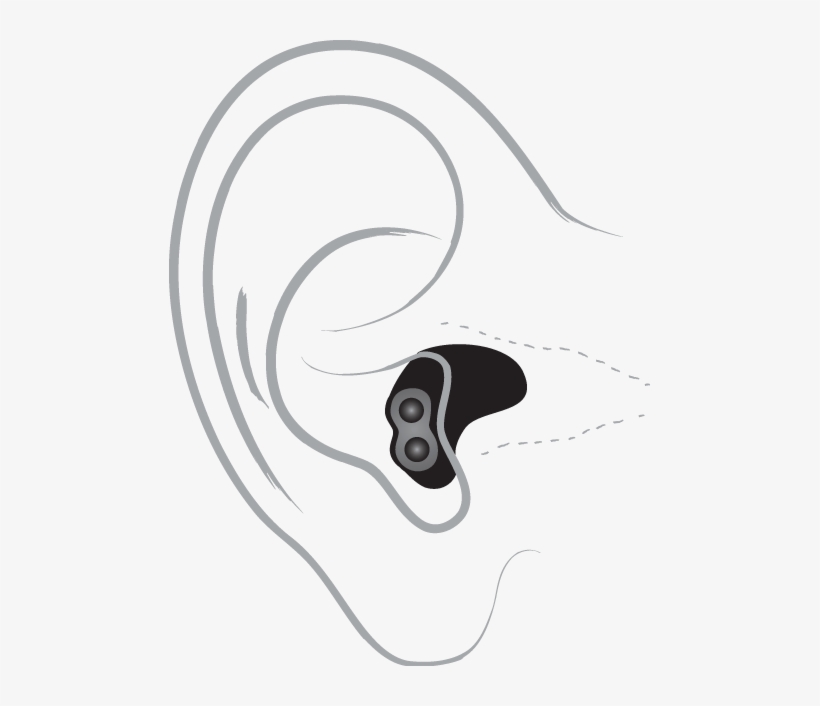 Ear Clipart Audiology - Hearing Aid, transparent png download