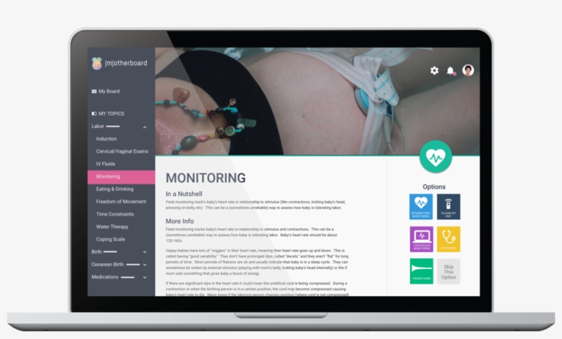 [m]otherboard Topic Laptop, transparent png download