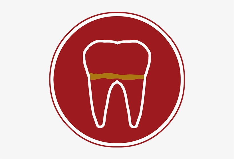 Gum Disease - Tooth, transparent png download