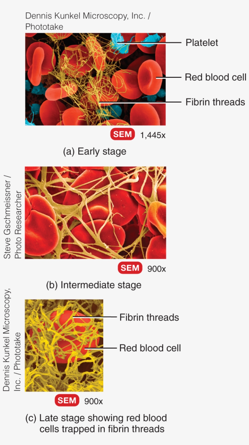 It Consists Of A Network Of Insoluble Protein Fibers - Pathophysiology Of Blood Disorders By Howard Franklin, transparent png download