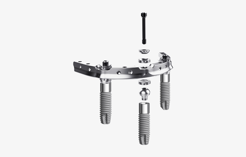 Side View Of Trefoil Bar And Implants - Trefoil System Nobel Biocare, transparent png download