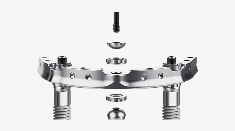 Even To The Casual Observer, It's Obvious That Trefoil - Trefoil Nobelbiocare, transparent png download