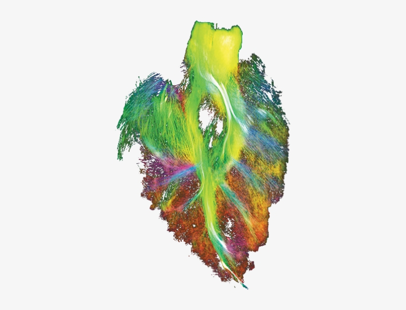 It's A Human Brain - Emotional Branding, transparent png download