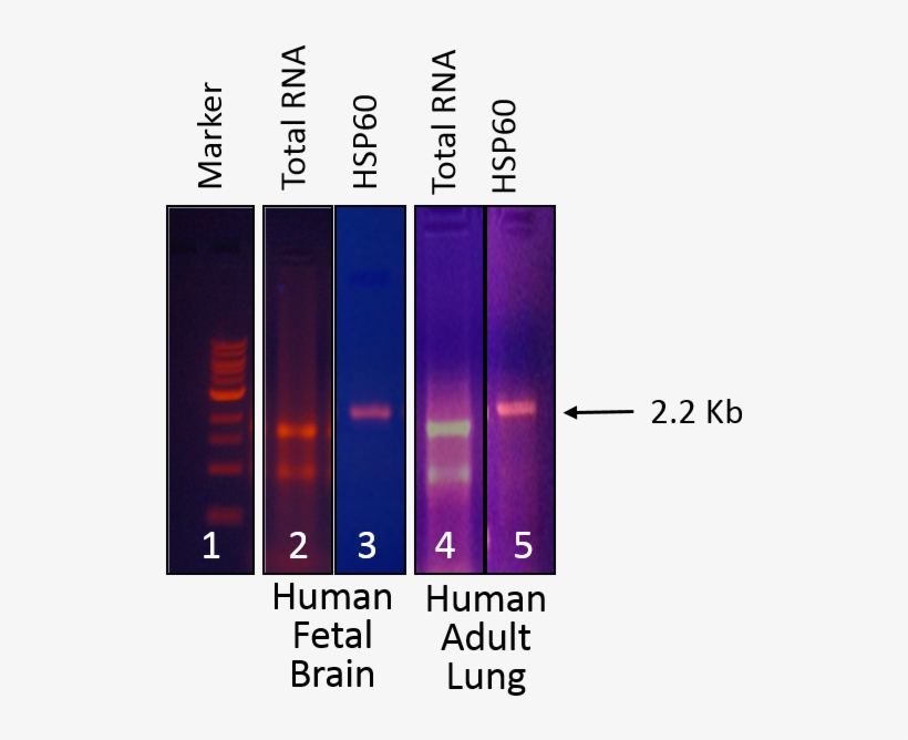 Human Fetal Brain And Human Adult Lung (lines 4, 5) - Colorfulness, transparent png download